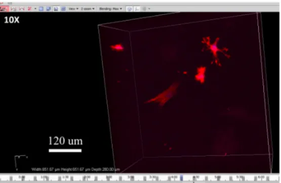 Figure 6: Confocal microscopy image of astrocytes in a gel completely made of matrigel