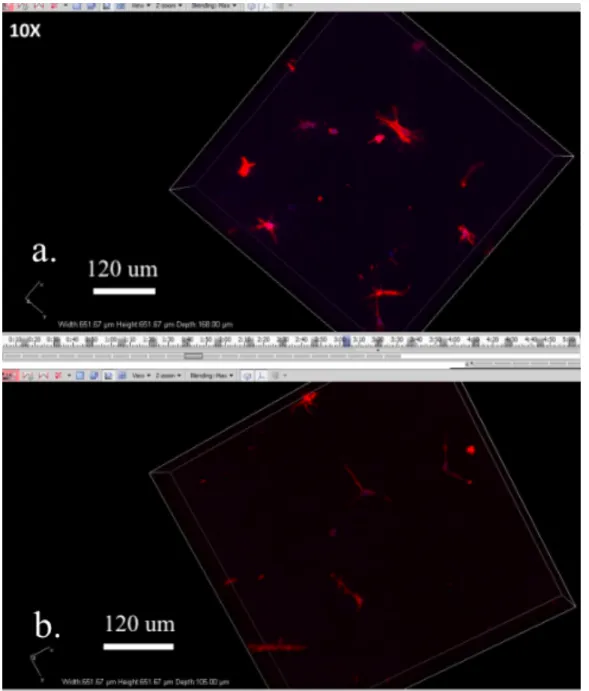 Figure 7: Confocal microscopy images of astrocytes in a (a) matrigel + 0.25 w/v% HA + 0.1 w/v% 