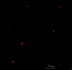 Figure 9: Live/dead assay image of astrocytes in gel 1 from Table 1 (done on confocal microscope)