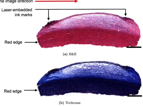 Figure  2-5:  Registration  marks  in the  histological  sections.  Scale  bar,  1 mm