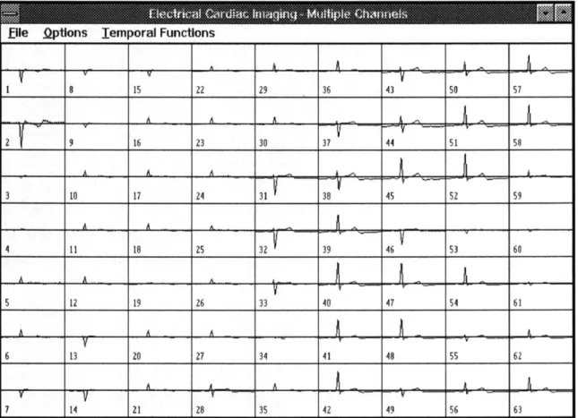 Figure  3-2: The  multiple channel analysis  window.