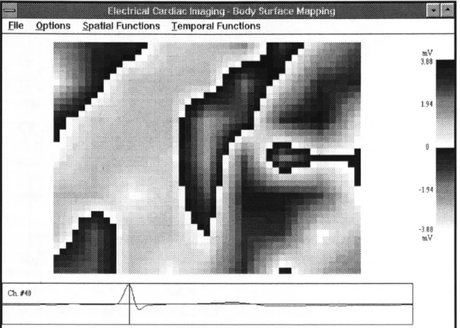 Figure  4-2  The  spatial  analysis  window.