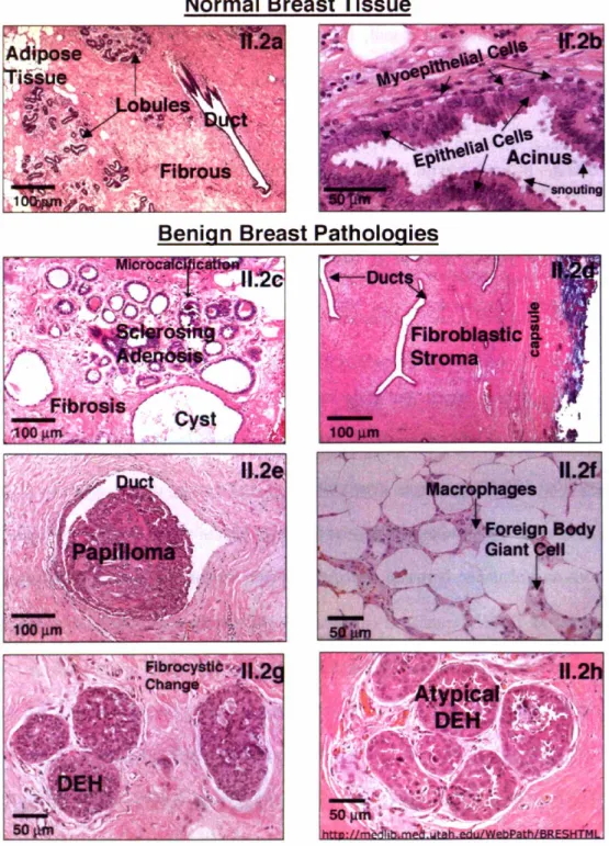 Figure 11.2. H&amp;E images of a-b) normal and c-h) benign tissues.