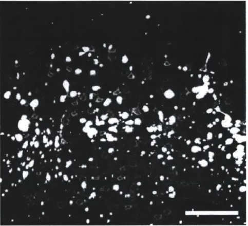 Figure 41 Poor membrane  expression  and intracellular blebbing in Halo  transgenic mice