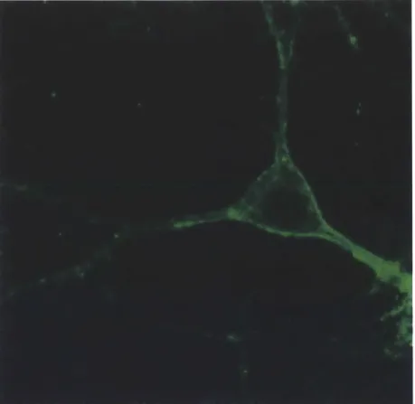 Figure 7  1 Confocal  fluorescence  image  of a lentivirally  infected  cultured neuron expressing  Arch-GFP under the CamKII promoter.