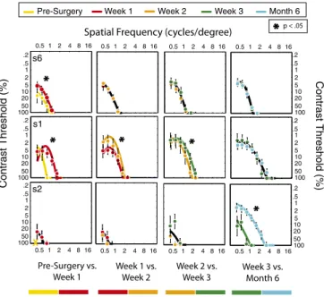 Fig. 2. Short-term contrast sensitivity assessment. For three patients (one in each row), contrast sensitivity was evaluated over a finer schedule:  pre-surgery, 1, 2, and 3 wk after pre-surgery, and 6 mo after surgery