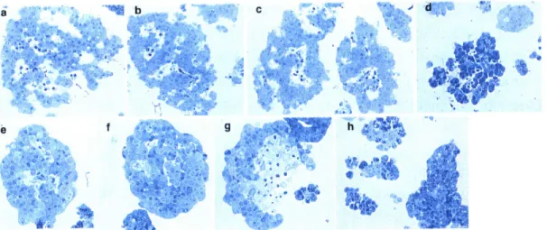Figure  2.1.  Toluidine  blue  stained  1-pm  plastic  sections  of  purified  human  islet preparations.