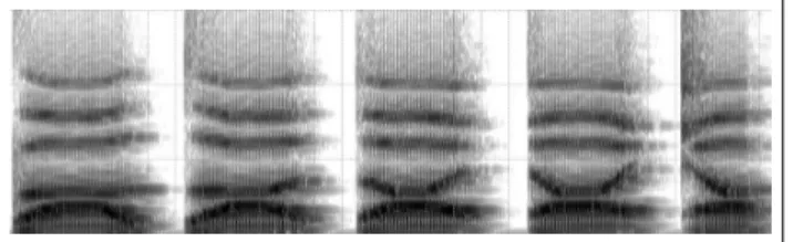 Figure 1. Sonogramme ( 0 − 8000 Hz) du bruit d’occlu- d’occlu-sion produit par le Digitartic, avec le lieu d’articulation qui évolue le long de l’axe bilabial - alvéo-dental - palatal (de gauche à droite)