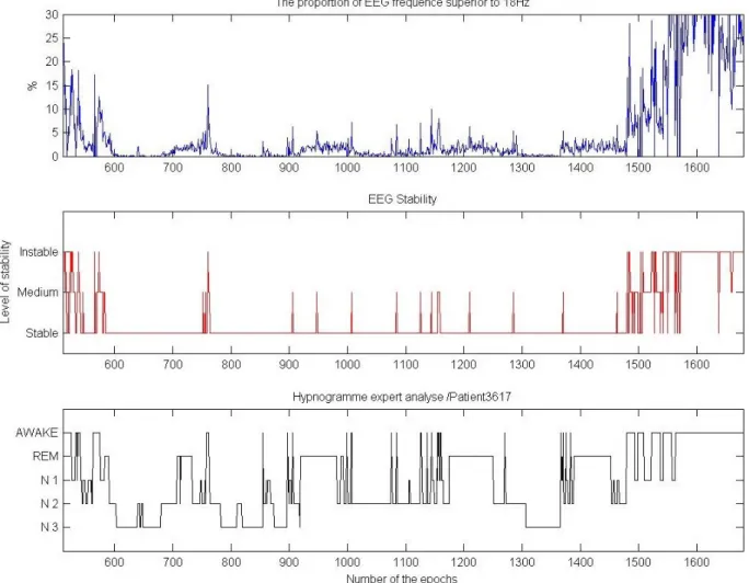Figure 2.18 – Comparaison entre les valeurs du paramètre EEGVariabilite1 et l’hypno- l’hypno-gramme