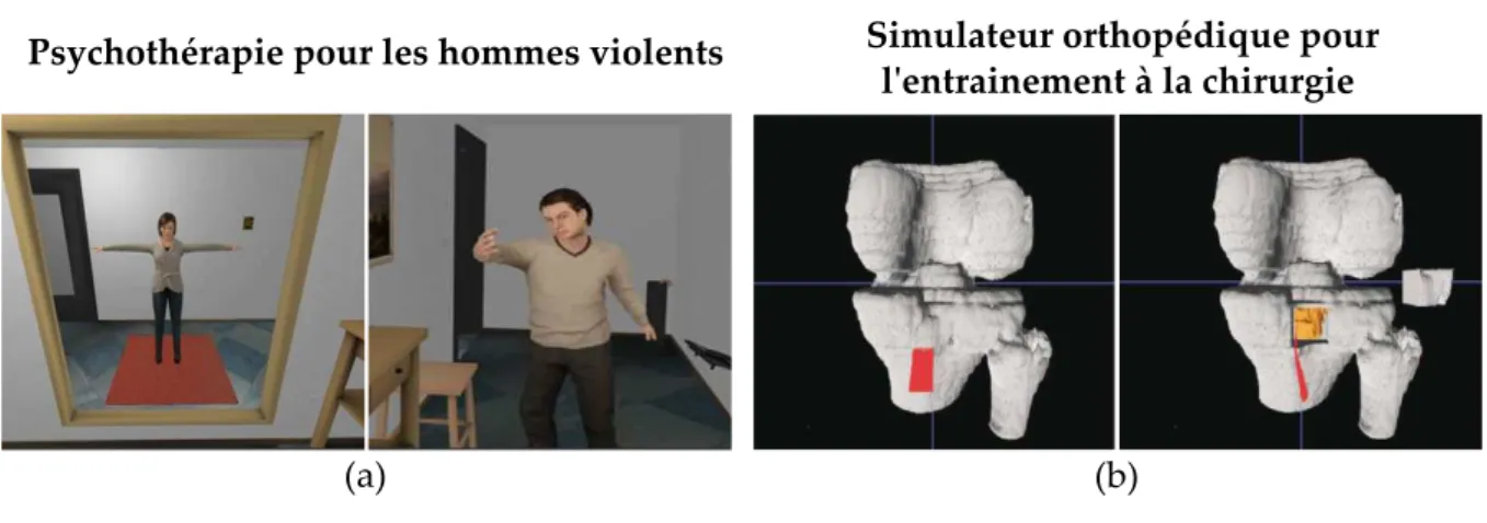 Figure 1.4. La Réalité Virtuelle est également exploitée dans le domaine médical pour la psy- psy-chothérapie des hommes violents [Seinfeld et al., 2018] (a) ou l’entrainement orthopédique [Tsai et al., 2001] (b).