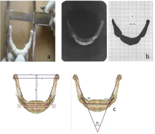 Figure I. 6 : Méthodes de mesure de l'os hyoïde  a : méthode de mesure directe sur os sec (D'Souza et al