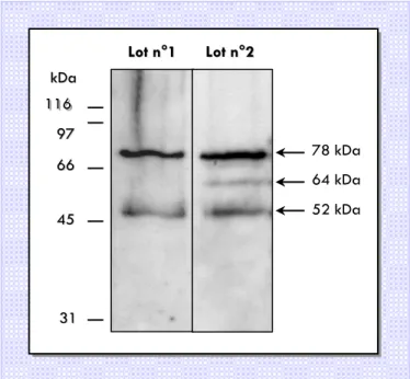 Figure 11.  Comparaison du profil protéique reconnu par les  anticorps anti-HaWLIM-1 dans deux lots différents de  protoplastes d’hypocotyles de tournesol