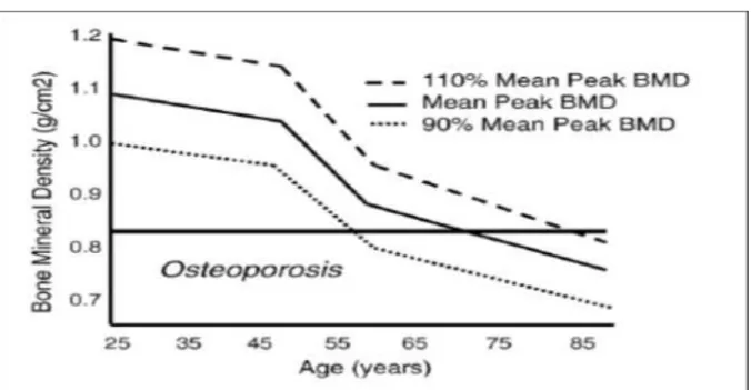 Figure 3: Pic de la DMO à l’âge de 25 ans et apparition de l’ostéoporose en fonction de l’âge  [31] 