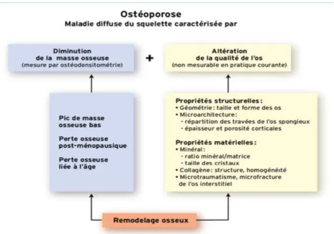 Figure 9 :  Les déterminants de la fragilité osseuse dans l’ostéoporose d’après (Roux et al