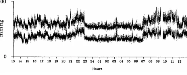 Figure 28. Enregistrement continu de la pression intra-artérielle systolique et diastolique pendant 24-h chez un  sujet sain (D’après Castiglioni et al