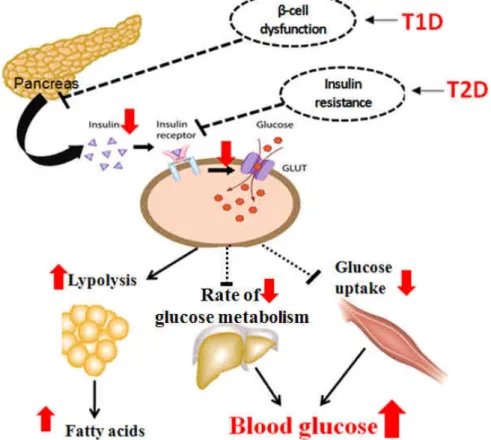Figure 1. Metabolic defects induced by insulin deficiency and insulin resistance in diabetes