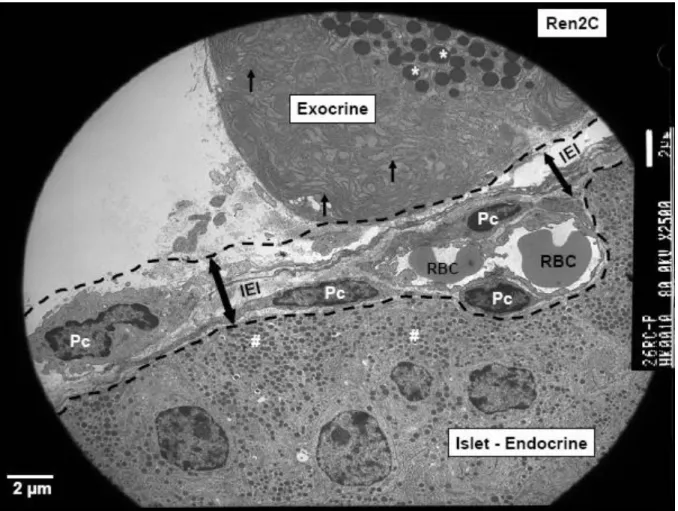 Figure 3 : Islet exocrine interface - IEI in rat model (Hayden MR, JOP 2007) 