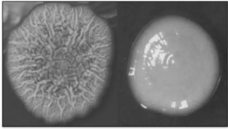 Figure IV: Smooth (right) and rough (left) colonies of M. abscessus on 7H11 agar   (Kai et al., 2014) 