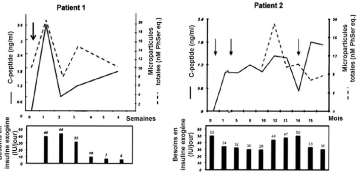 Figure 15 : Variations du C-peptide, du besoin en insuline et des microparticules circulantes lors  de la greffe d'îlots pancréatiques 