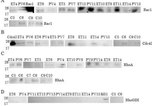 Figure I-4 shows that IQGAP1 could form a complex with Rac1, Cdc42 and RhoA but  not  with  RhoGDI  in  most  of  MPN  samples  independently  of  ET  and  PV  diagnosis