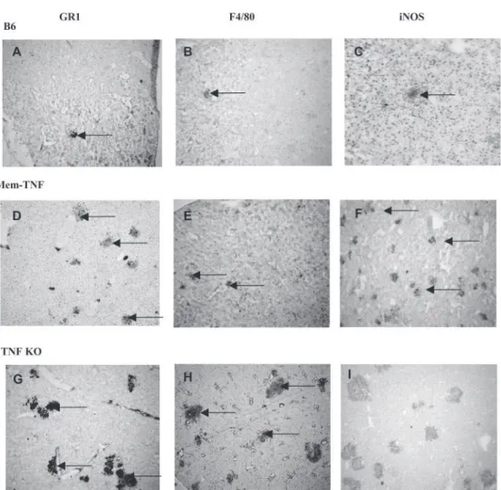 Figure 4. Increased neutrophil recruitment and iNOS expression in hepatic microabscesses from mem-TNF mice