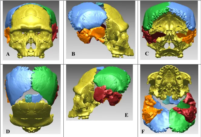 Figure 48 : Intégration virtuelle des os temporaux de Ceprano 1 sur notre proposition d’Arago  21-47 en vues : A : frontale ; B : profil droit ; C : postérieure ; D : supérieure ; E : profil 