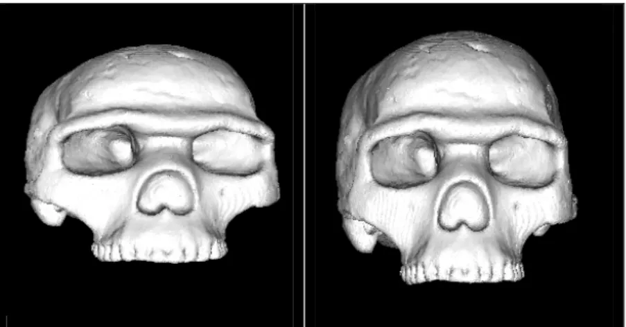 Figure 12 : Distorsion extrême de la reconstruction tridimensionnelle du crâne de Skhul 5  (gauche) et reconstruction correcte (droite)
