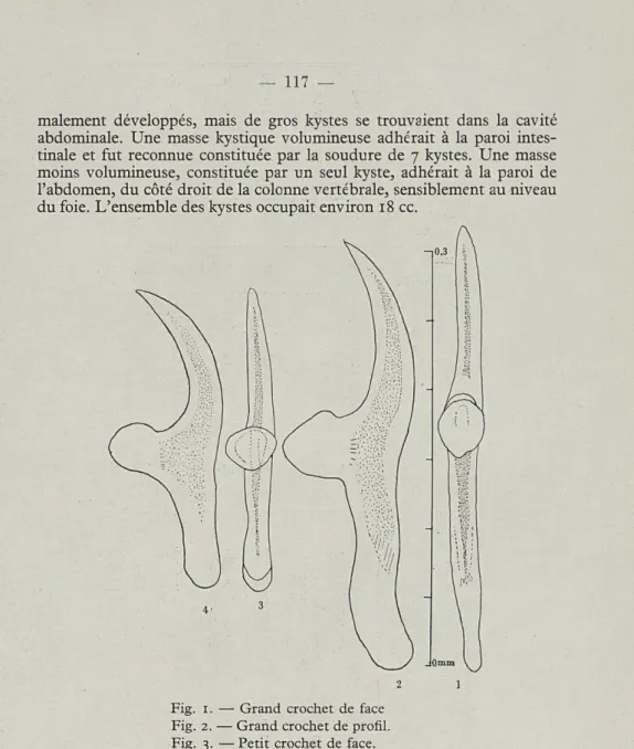 Fig.  1.  —  Grand  crochet  de  face  Fig.  2.  — Grand crochet de  profil  Fig.  3.  — Petit  crochet  de  face