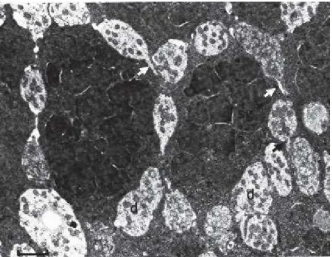 Figure  2:  Vue  en  microscopie  électronique  d'une  coupe  parallèle  à  la  surface  de  la  muqueuse  olfactive.