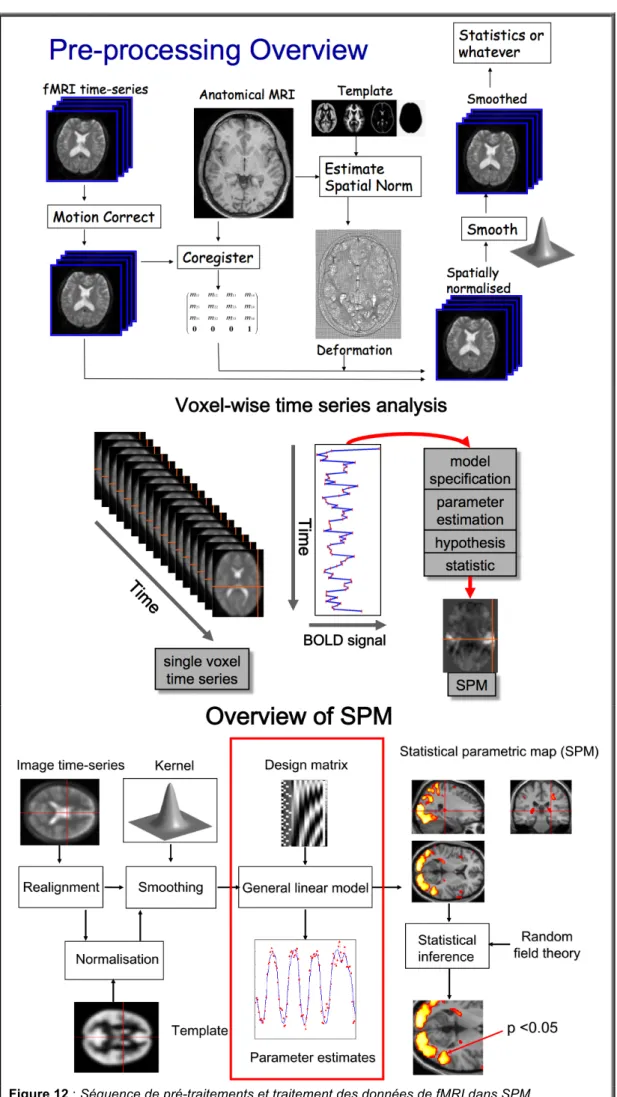 Figure 12 : Séquence de pré-traitements et traitement des données de fMRI dans SPM  #