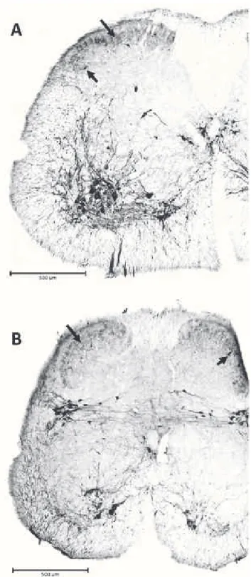 Figure 3.2: Populations cholinergiques de la moelle ´ epini` ere de souris. Immuno-d´etection de la choline ac´etyl transferase (ChAT) dans des sections transverses (50µm) de moelle ´epini`ere de souris adulte.