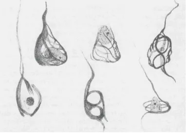 Figure 4: Dessins des dégénérescences neurofibrillaires d’Auguste Deter dessinés par Aloïs Alzheimer 
