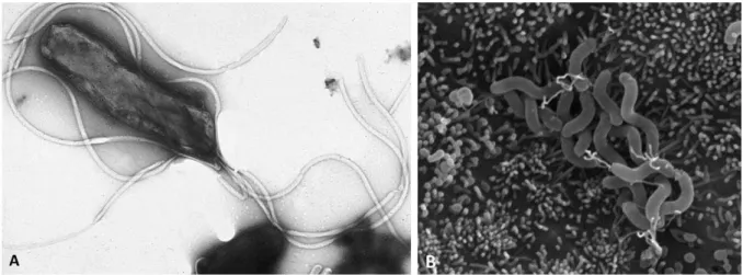Figure 7.  Helicobacter pylori  