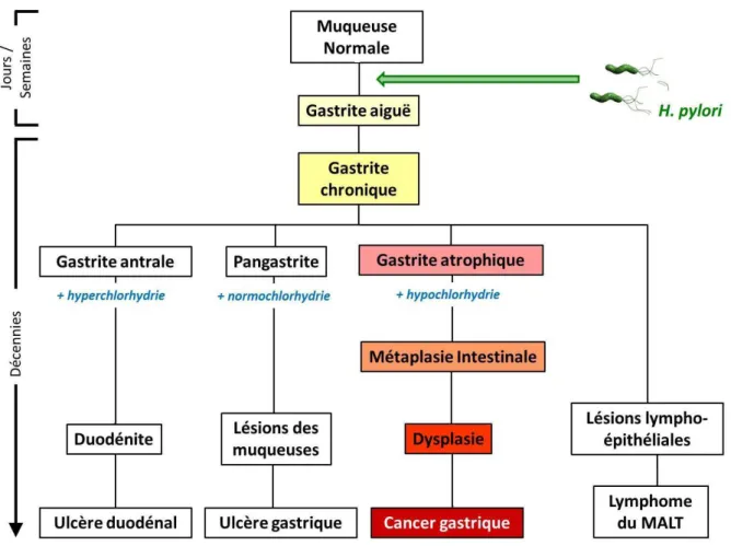 Figure 13.  Rôle de H. pylori dans le développement des pathologies gastro- gastro-duodénales 