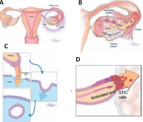 Figure 3 : Transfert de l’épithélium de la trompe de Fallope vers l’ovaire (Kurman and Shih, 2010)