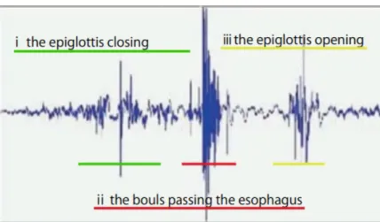 Figure 3.3: Characteristics of the swallowing sound wave