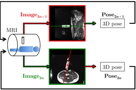 Figure 2.3: Principle of Workflow: two orthogonal image planes, transversal (green border) and sagittal (red border) are alternately acquired