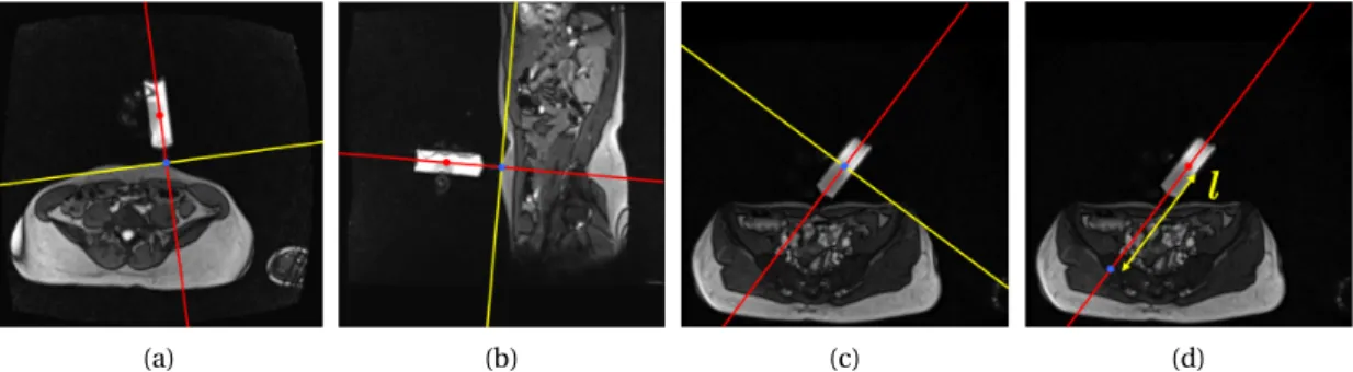 Figure 2.11: Image plane positioning using different strategies. The first strategy (a-c) defines the position of the next image (blue point) plane at the intersection between the marker axis (red) and an orthogonal line (yellow) passing through the image 