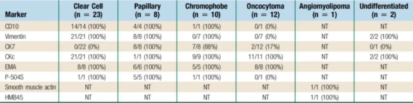 Tableau 2 : Expression des marqueurs pour les 56 tumeurs nécessitant un marquage par  immunohistochimie 