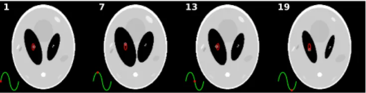 Fig. 2. (a) Reconstructions of a Shepp-Logan phantom 256×256 , from a set of 60 projections with 512 detector pixels, with both the B-spline projector using cubic B-splines and the distance driven projector