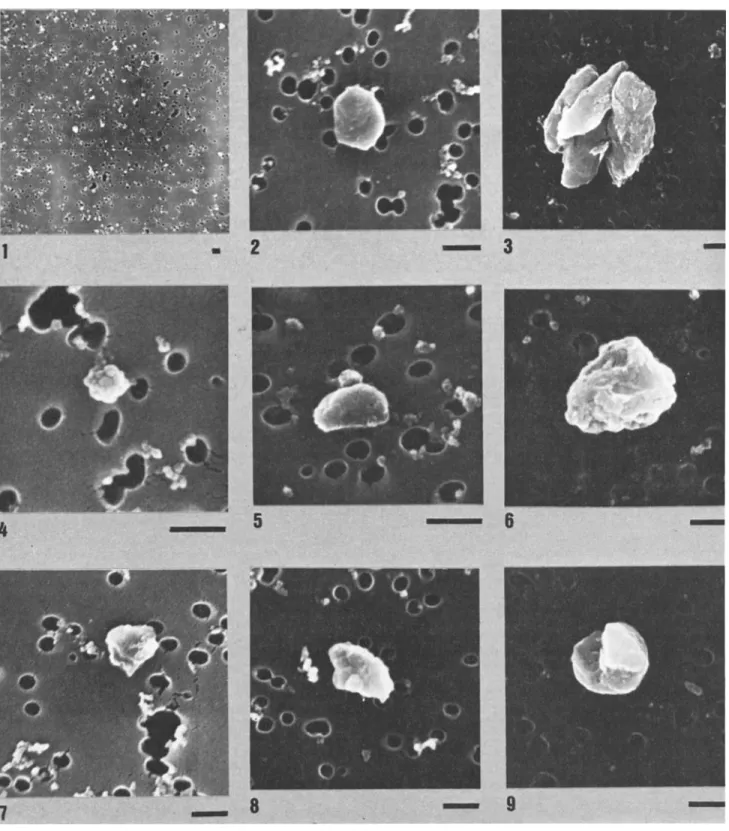 Fig.  14.  Dust  Trapped  on  Filters.  Graphic  scale  is  1  •m.  Number 1  indicates  general  v•ew  of  a  filter;  2,  a  micaceous  particle;  3,  altered  spindles  of  micrite;  4,  a  Si  particle;  5,  a  Ca particle;  6,  A1  carbonate  grain;  