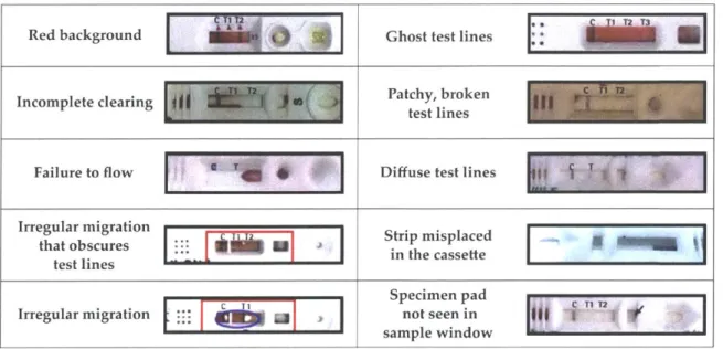 Figure 2-2:  Malaria  RDT anomalies  encountered  in production  lots.  Figure reproduced with permission  from  [611.