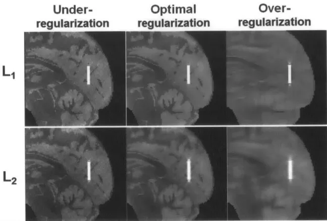 Figure  3.1.  Susceptibility mapping  results with  -e-  and  e 2 - regularization  in  numerical  simulation  of a  parallel  vessel