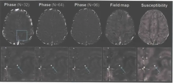 Figure  3.4.  Parallel  vessel  identified  on  the  same  slice  in  phase,  field  map,  and  susceptibility images