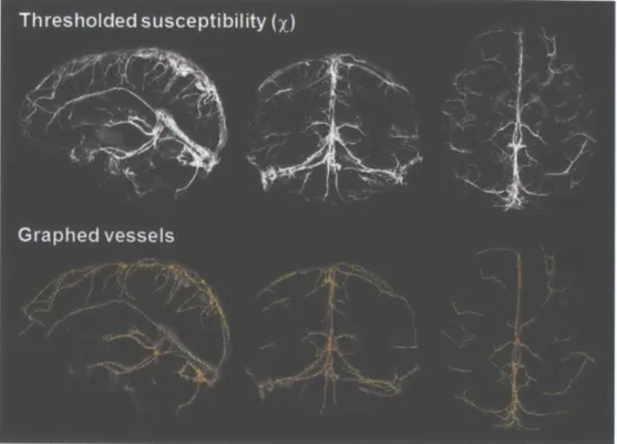 Figure  3.7.  Susceptibility  map  in  one  healthy  volunteer  thresholded  at  X  >  0.15,  and  the corresponding  vessels that are graphed  by the Volumetric Image  Data  Analysis software  in  MATLAB (Tsai  et al.,  2009)