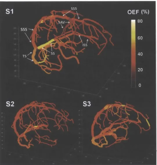 Figure  3.8.  Quantitative  oxygenation  venograms  which  display  baseline  OEF  along  each  vein  in three  healthy  volunteers