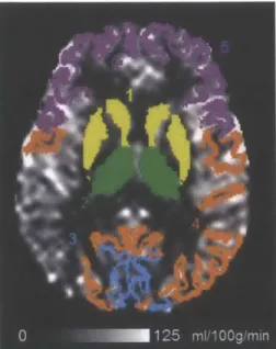 Figure  4.11.  Regions  of  interest  (ROI)  defined  from Freesurfer  (http://surfer.nmr.mqh.harvard.edu)  cortical segmentation  for  quantification  of  local  cerebral  blood  flow (CBF) on  arterial spin  labeling data  in  one healthy subject.