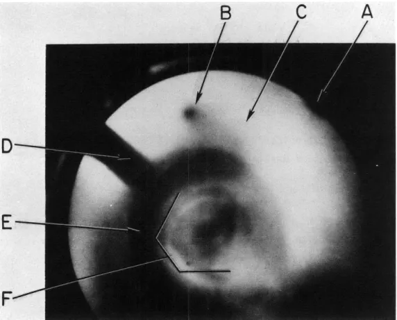 Fig.  II-i.  AEM  micrograph of  butt end  of 3-mil  diam tungsten  wire which  has  been rubbed  on  graphite