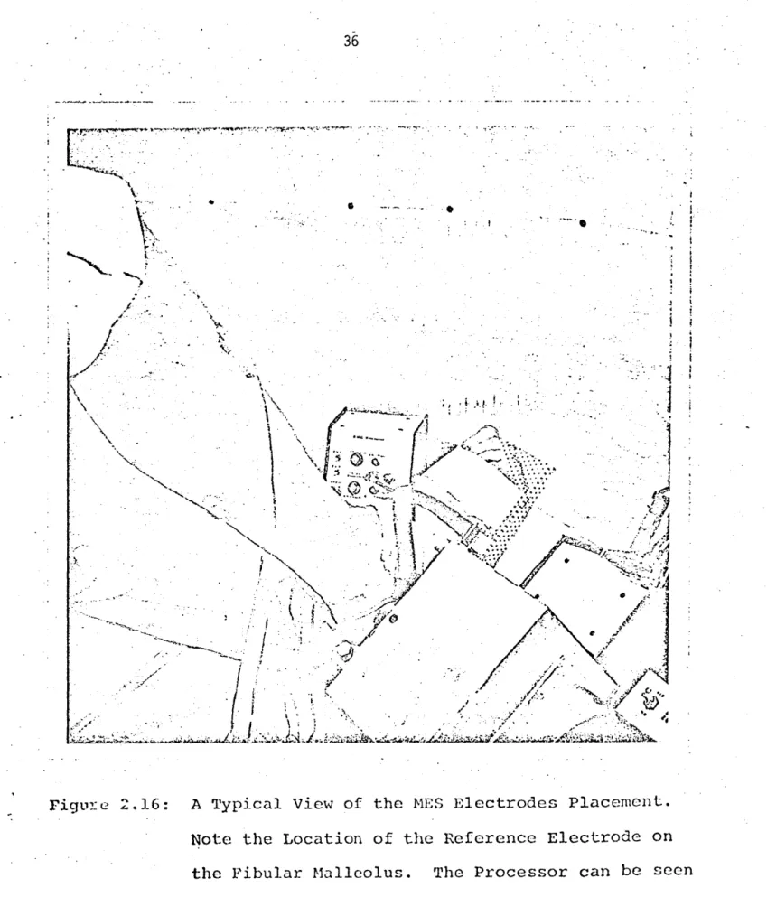 Figure  2.16: A  Typical  View  of  the  MES  Electrodes  Placement.