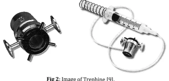 Fig 2:  Image  of Trephine  [9].